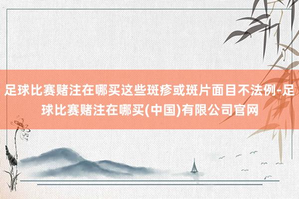 足球比赛赌注在哪买这些斑疹或斑片面目不法例-足球比赛赌注在哪买(中国)有限公司官网